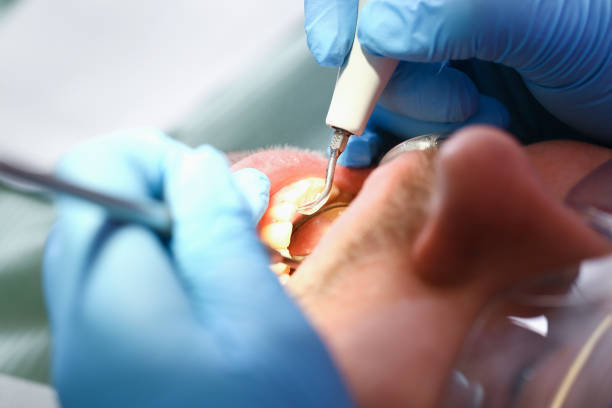Best After-Hours Dental Trauma Care in Scandia, MN