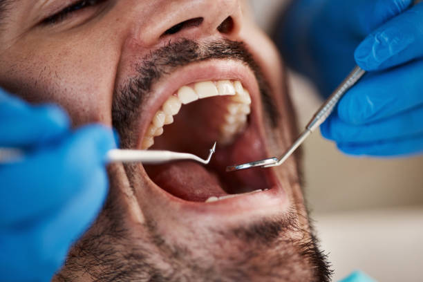 Best Urgent Care for Lost Fillings or Crowns in Scandia, MN