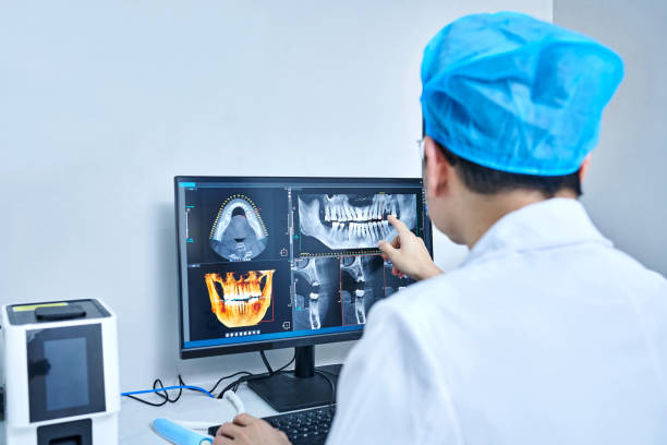 Best Emergency Root Canal Treatment in Scandia, MN