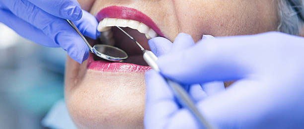Best Emergency Dental Care for Broken or Chipped Teeth in Scandia, MN